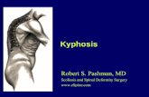 Kyphosis - eSpine