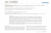Case report Capillary hemangioma as a rare benign tumor of ...