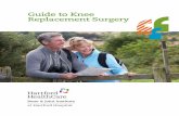 Guide to Knee Replacement Surgery