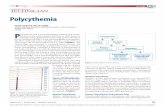 Polycythemia - Amazon S3