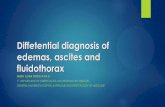 Diffetential diagnosis of edemas, ascites and fluidothorax