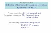 Detection of Ischemic ST segment Deviation Episode in the ECG