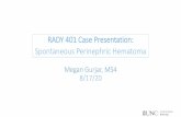 RADY 401 Case Presentation: Spontaneous Perinephric Hematoma