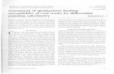 Assessment of spontaneous heating susceptibility of coal ...