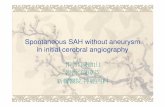 Spontaneous SAH without aneurysm in initial cerebral ...