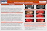 Jatana Poster FS - ResearchPosters