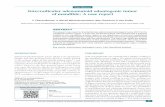 Case Report Interradicular adenomatoid odontogenic tumor ...