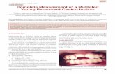 Complete Management of a Mutilated Young Permanent Central ...