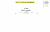 Study Guide: Optic neuropathy