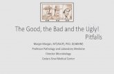 The Good, the Bad and the Ugly! Pitfalls