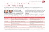 TROE NAPHOT Intracranial MRI Vessel- Wall Imaging