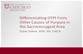 Differentiating DTPI From Other Causes of Purpura in the ...