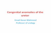 Congenital anomalies of the ureter