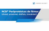 NCB® Periprotésicas de fémur - Hospitrauma