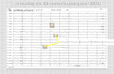 Recording the Electroencephalogram (EEG). Recording the EEG