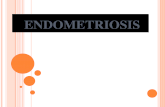 Endometriosis 1