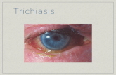 Trichiasis. Conjunctiva & Sclera Look at the bulbar (the eye) & palpebral (inside of the lids) conjunctiva Injection & erythema; what is the distribution