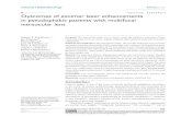 Outcomes of excimer laser enhancements in pseudophakic ... ... All eyes were treated with VISX STAR