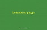 Endometrial polyps